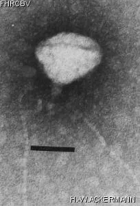 HER444 Image of phage under microscope