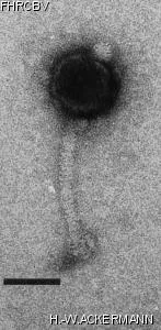 HER45 Image of phage under microscope