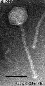 HER457 Image of phage under microscope