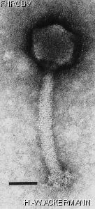 Image of phage under microscope