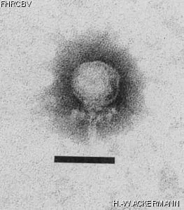 Image of phage under microscope