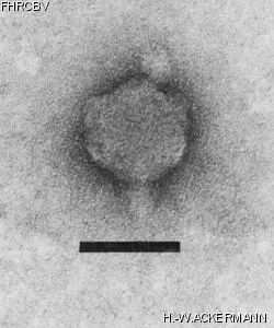 HER5 Image of phage under microscope