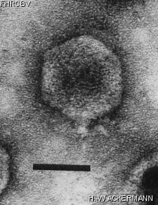 HER51 Image of phage under microscope