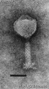 Image of phage under microscope
