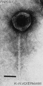 HER54 Image of phage under microscope