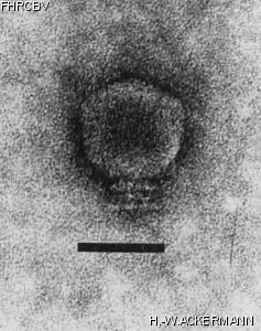 HER60 Image of phage under microscope