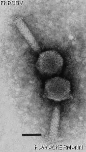 HER62 Image of phage under microscope