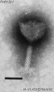 HER64 Image of phage under microscope