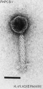 Image of phage under microscope