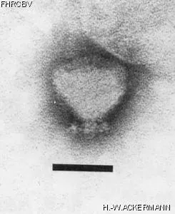 HER68 Image of phage under microscope