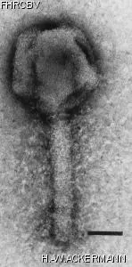 HER7 Image of phage under microscope