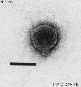 Image of phage under microscope