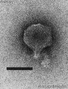 HER74 Image of phage under microscope