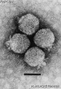 HER77 Image of phage under microscope