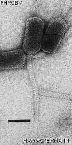 Image of phage under microscope