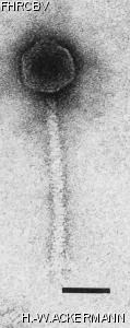 HER8 Image of phage under microscope