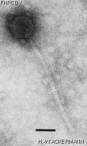 HER81 Image of phage under microscope