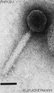 Image of phage under microscope