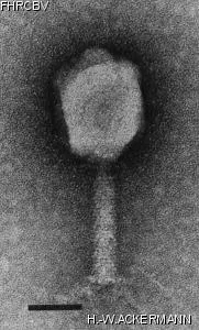 HER85 Image of phage under microscope