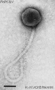 HER86 Image of phage under microscope