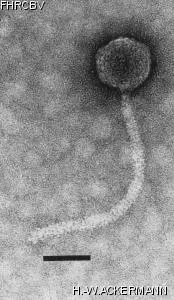 HER88 Image of phage under microscope
