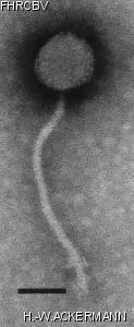 HER89 Image of phage under microscope