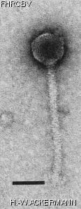 HER9 Image of phage under microscope