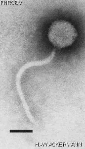 Image of phage under microscope