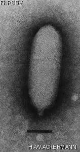 HER94 Image of phage under microscope