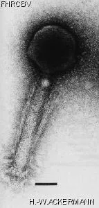 HER97 Image of phage under microscope