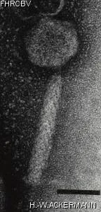 Image of phage under microscope
